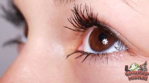 Niat Tetes Mata, Malah Kena Lem! Endingnya di RS