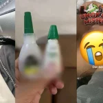 Niat Tetes Mata, Malah Kena Lem! Endingnya di RS